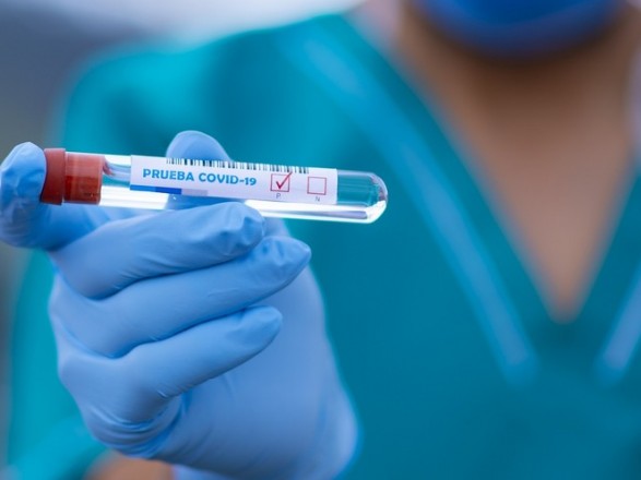 В Україні тепер можна не робити ПЛР-тест на коронавірус після самоізоляції, але є нюанс В Україні тепер можна не робити ПЛР-тест на коронавірус після самоізоляції, але є нюанс