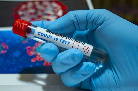 Ситуація з коронавірусом, станом на понеділок: багато нових хворих та троє людей померло