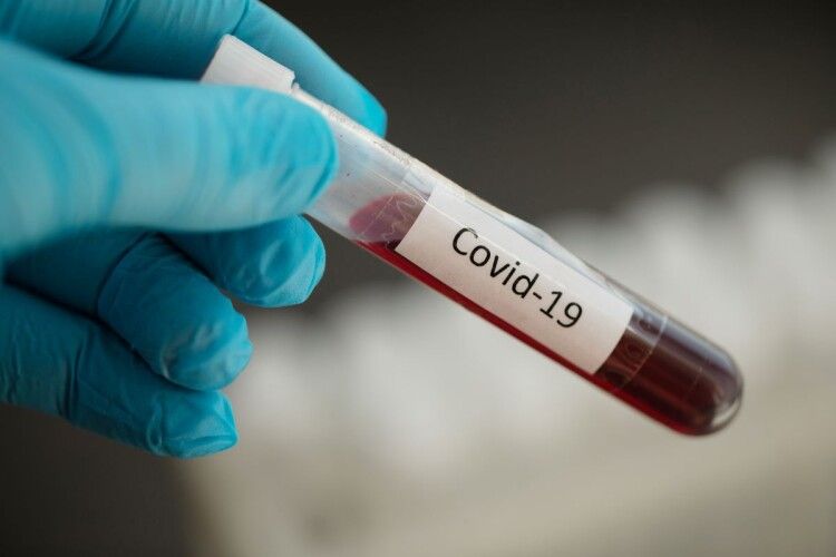 За добу в Україні виявили шокуючу кількість хворих на COVID-19 За добу в Україні виявили шокуючу кількість хворих на COVID-19