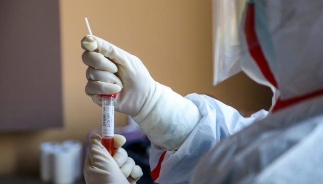 Чехія почала кампанію масового тестування на коронавірус