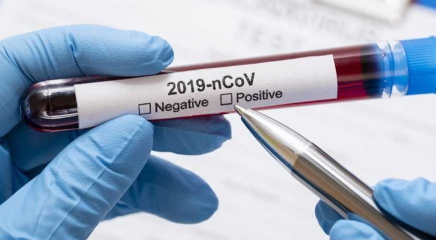 В області зменшується добова кількість нових інфікувань коронавірусом 