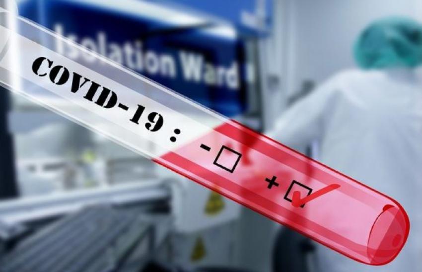 Вчені назвали можливі головні наслідки COVID-19 Вчені назвали можливі головні наслідки COVID-19