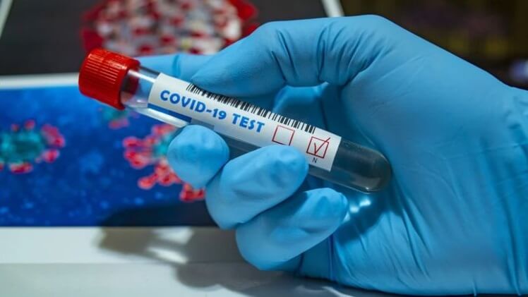 За добу в області померло чимало пацієнтів, у яких виявили COVID-19 За добу в області померло чимало пацієнтів, у яких виявили COVID-19