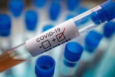 Статистика хворих на коронавірус: за добу померло чимало закарпатців, у яких виявили COVID-19