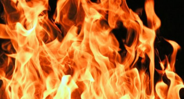 Закарпатець отримав опіки під час пожежі у будинку Закарпатець отримав опіки під час пожежі у будинку