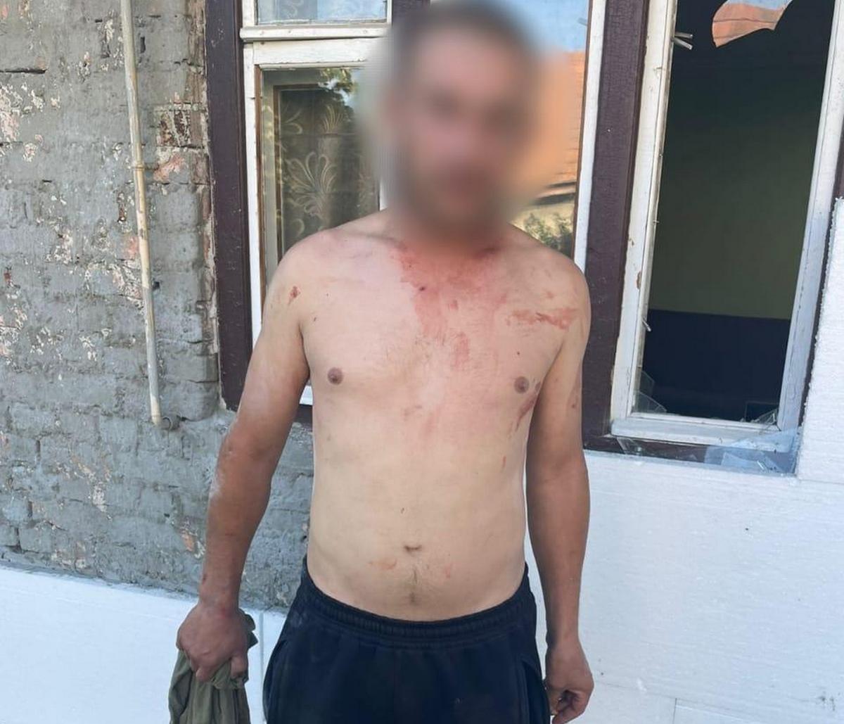 Закарпатець ледь не вбив співмешканця своєї сестри: потерпілий у реанімації Закарпатець ледь не вбив співмешканця своєї сестри: потерпілий у реанімації
