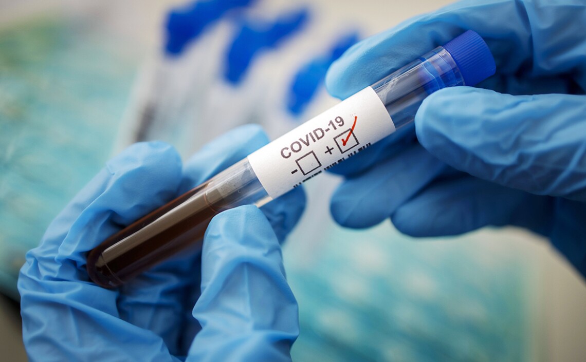 Відомо, скільки людей госпіталізували з COVID-19 у Мукачеві за тиждень Відомо, скільки людей госпіталізували з COVID-19 у Мукачеві за тиждень