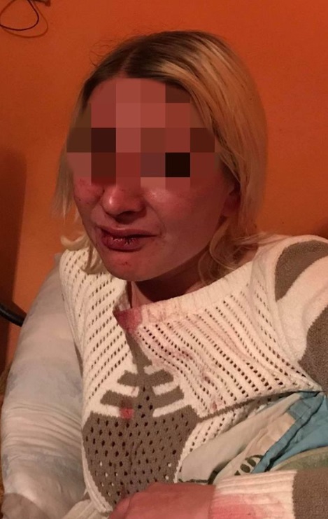 У Королеві побили працівницю кафе У Королеві побили працівницю кафе